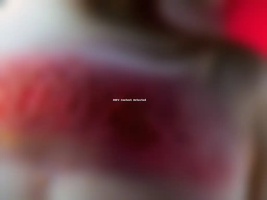 Detalle impactante de piel con psoriasis, mostrando parches rojos con escamas plateadas